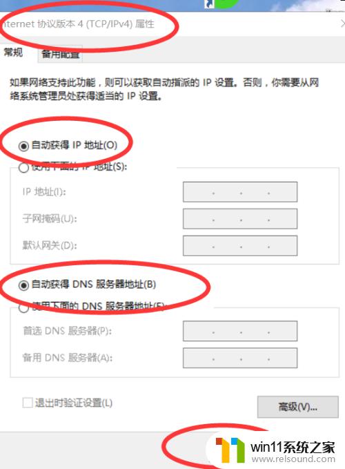 win10设置自动获取ip地址的方法_win10如何设置自动获取ip地址