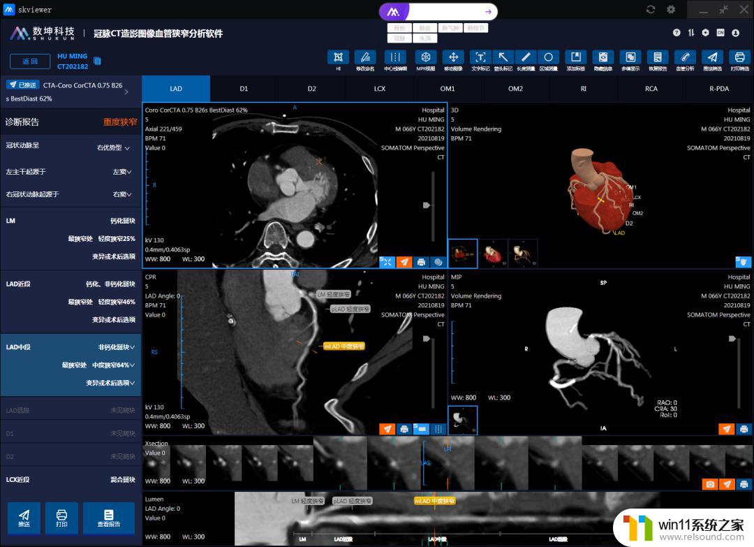 微软展示LLaVA-Med AI模型，可读CT和X光片，助力医疗影像诊断